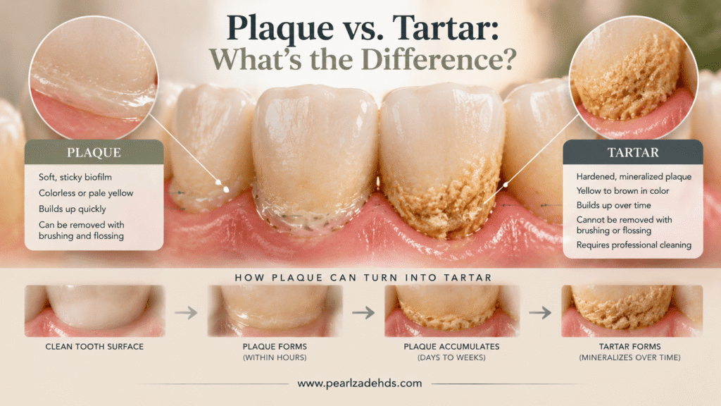 Plaque vs. Tartar
