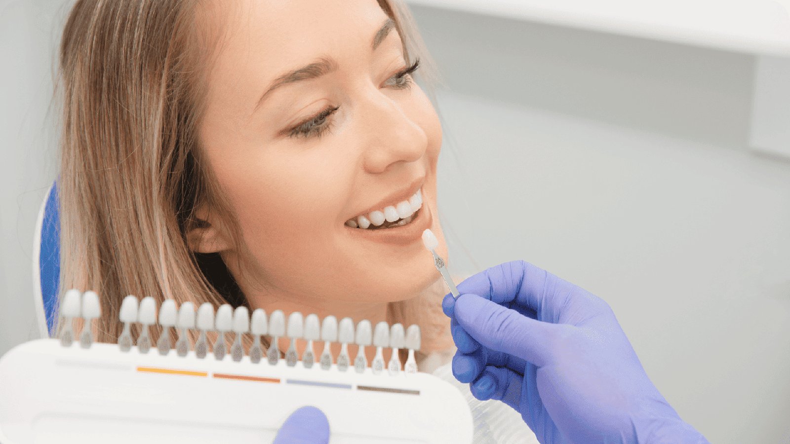 Porcelain vs Composite Veneers