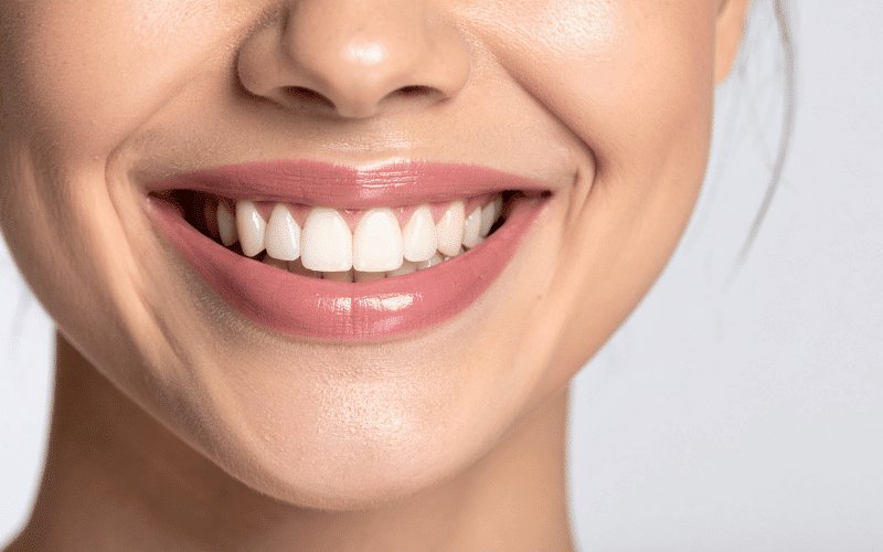 digital smile design image