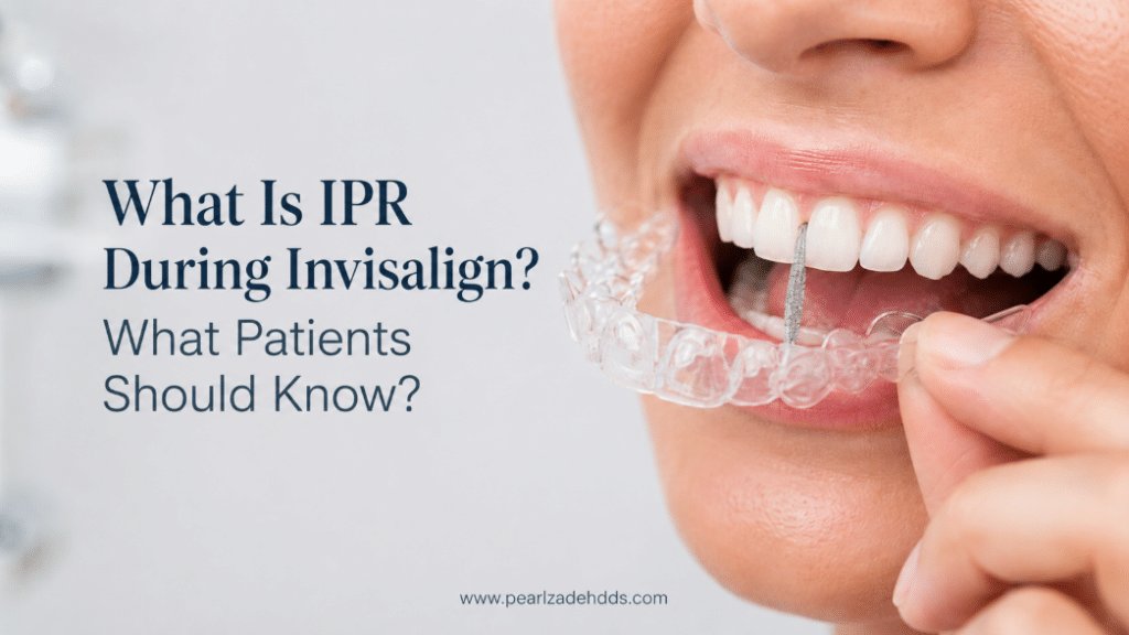 What Is IPR During Invisalign