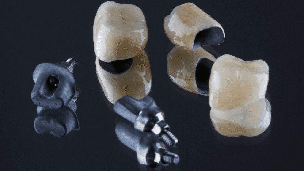 Why Are My Gums Bleeding After a Dental Crown