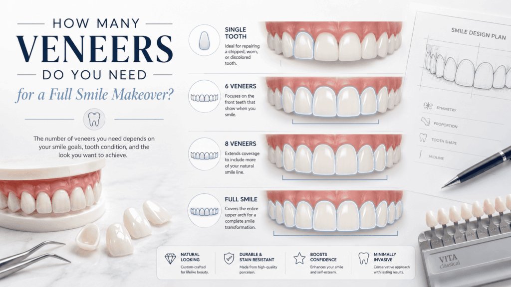 How Many Veneers Do You Need for a Full Smile Makeover